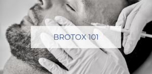 botox for men,men with botox,mens botox before and after,men's botox,botox before and after men
