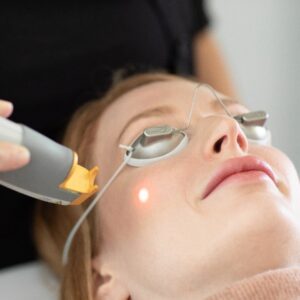 laser genesis skin treatment