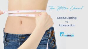 CoolSculpting vs Liposuction